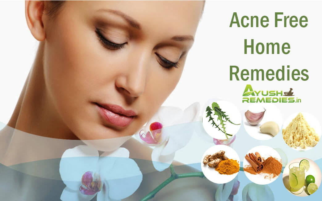 acne free home remedies