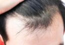 Hair Transplantation: Advantages & Disadvantages